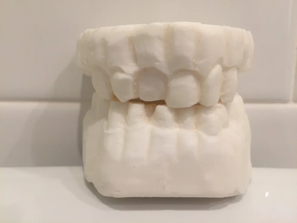 Hein's (David Bowie) Teeth