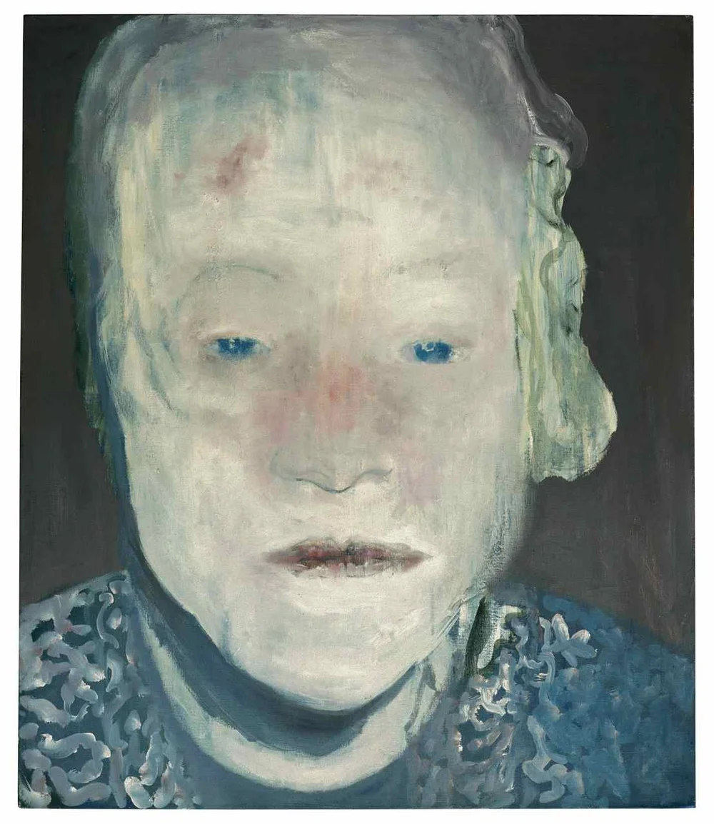 White Disease